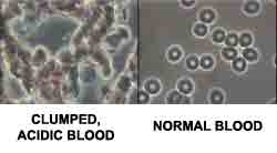 blood samples compared