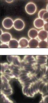 Comparison of blood cell distribution after Ionized water